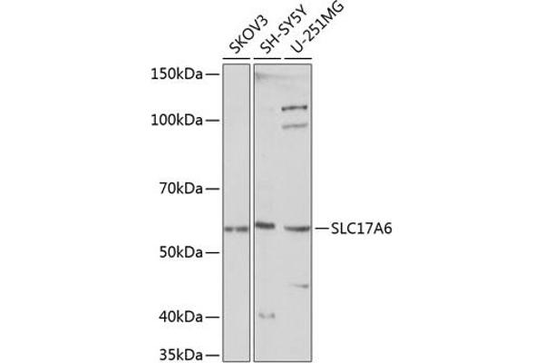 Solute Carrier Family 17 (Vesicular Glutamate Transporter), Member 6 (SLC17A6) (C-Term) Antikörper