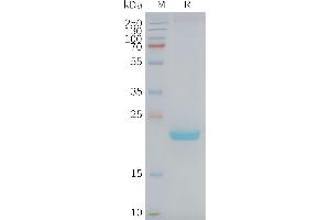 Human C-Nanodisc, Flag Tag on SDS-PAGE (Claudin 4 Protein (CLDN4))