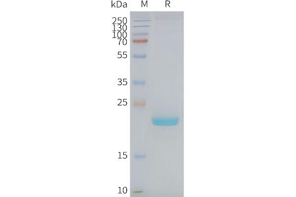 Claudin 4 Protein (CLDN4)