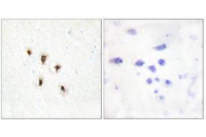 Immunohistochemistry (IHC) image for anti-Mevalonate Kinase (MVK) (Internal Region) antibody (ABIN1849535) (MVK Antikörper  (Internal Region))