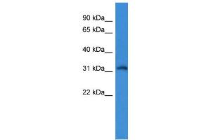 WB Suggested Anti-KCNIP4 Antibody Titration: 0. (KCNIP4 Antikörper  (N-Term))