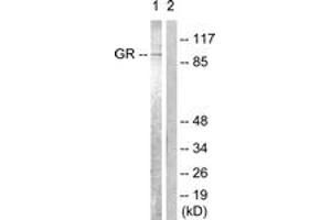Western blot analysis of extracts from Jurkat cells, treated with EGF 200ng/ml 15', using GR (Ab-226) Antibody. (GR (AA 201-250) Antikörper)