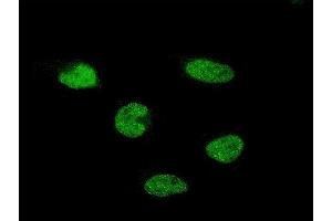 Immunofluorescence of monoclonal antibody to C11orf30 on HeLa cell. (EMSY Antikörper  (AA 1081-1178))