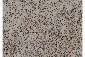 ABIN6279759 at 1/100 staining Mouse kidney tissue by IHC-P. (RGS22 Antikörper  (Internal Region))