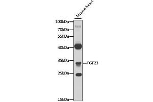 Western blot analysis of extracts of mouse heart, using FGF23 antibody. (FGF23 Antikörper)