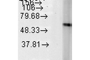 Western Blot analysis of Human Heat Shocked HeLa cell lysates showing detection of Hsp60 protein using Mouse Anti-Hsp60 Monoclonal Antibody, Clone LK-2 . (HSPD1 Antikörper  (PE))