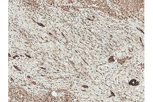 Immunohistochemistry analysis using Rabbit Anti-LRP1 Polyclonal Antibody (ABIN5696062). (LRP1 Antikörper  (AA 160-260) (PE))