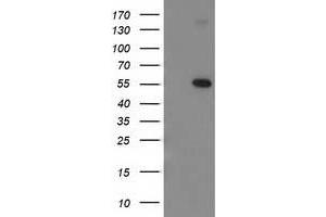 HEK293T cells were transfected with the pCMV6-ENTRY control (Left lane) or pCMV6-ENTRY TP53 (Right lane) cDNA for 48 hrs and lysed. (p53 Antikörper)