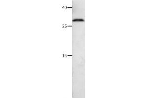 Western Blot analysis of 231 cell using MMP7 Polyclonal Antibody at dilution of 1:600 (MMP7 Antikörper)