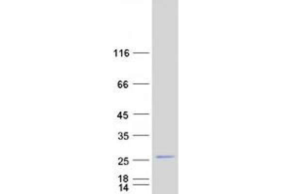 RAB25 Protein (Myc-DYKDDDDK Tag)