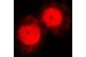 Immunofluorescent analysis of Annexin A1 staining in NIH3T3 cells. (Annexin a1 Antikörper  (Center))