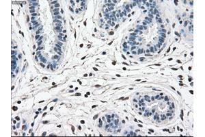 Immunohistochemical staining of paraffin-embedded breast tissue using anti-MAPK1 mouse monoclonal antibody. (ERK2 Antikörper)