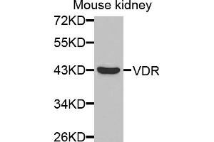 Western blot analysis of extracts of mouse kidney, using VDR antibody. (Vitamin D Receptor Antikörper)
