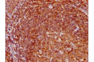 Immunohistochemistry (IHC) image for anti-Cyclin-Dependent Kinase Inhibitor 1B (p27, Kip1) (CDKN1B) antibody (ABIN7127421)