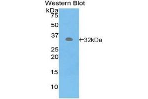 Western blot analysis of the recombinant protein. (PCK1 Antikörper  (AA 311-558))