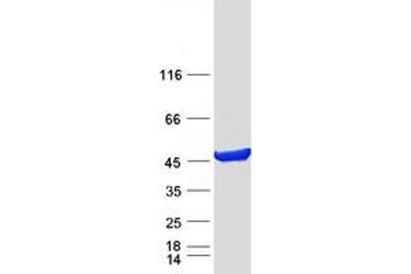 PAICS Protein (Transcript Variant 2) (Myc-DYKDDDDK Tag)