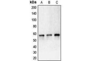 Western blot analysis of Carbonic Anhydrase 9 expression in HeLa (A), Ramos (B), Molt4 (C) whole cell lysates. (CA9 Antikörper  (Center))