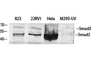 Western Blot analysis of 823 (1), 22RV1 (2), Hela (3), M293-UV (4), diluted at 1:500. (Smad2/3 Antikörper)