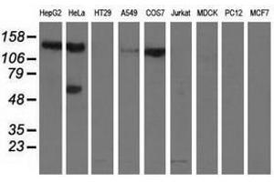 Image no. 2 for anti-L1 Cell Adhesion Molecule (L1CAM) antibody (ABIN1499090) (L1CAM Antikörper)