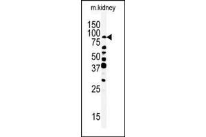 Western blot analysis of anti-ANKRD3- Pab (ABIN392243 and ABIN2841934) in mouse kidney tissue lysate (35 μg/lane). (RIPK4 Antikörper  (C-Term))