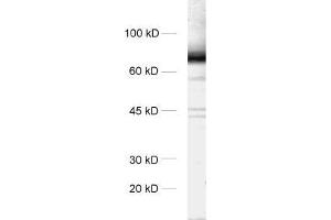 dilution: 1 : 1000, sample: rat brain homogenate (STXBP1 Antikörper)