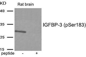 Western blot analysis of extracts from Rat brain tissue using IGFBP-3 (Phospho-Ser183) antibody. (IGFBP3 Antikörper  (pSer183))