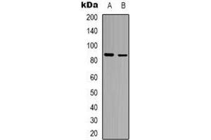 Western blot analysis of FRS2 expression in MCF7 (A), Hela (B) whole cell lysates. (FRS2 Antikörper)