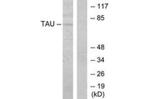 Western blot analysis of extracts from MDA-MB-435 cells, using Tau (Ab-205) Antibody. (tau Antikörper  (AA 491-540))