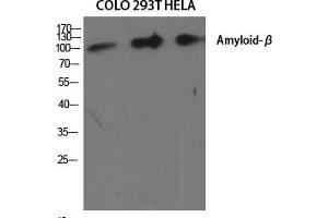 Western Blot analysis of various cells using Amyloid-β Polyclonal Antibody diluted at 1:2000. (beta Amyloid Antikörper)