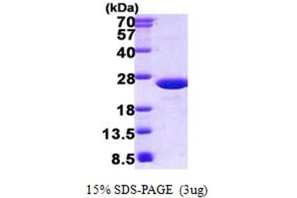 SLC25A19 Protein (AA 19-180) (His tag)