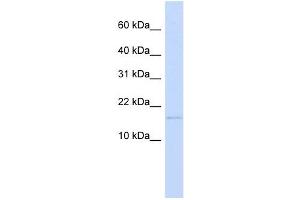 C3ORF18 antibody used at 1 ug/ml to detect target protein. (C3orf18 Antikörper  (N-Term))