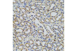 Immunohistochemistry of paraffin-embedded rat kidney using TRMT2A antibody. (TRMT2A Antikörper)
