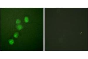 Immunofluorescence analysis of HuvEc cells, using Cyclin E1 (Ab-395) Antibody. (Cyclin E1 Antikörper  (AA 361-410))