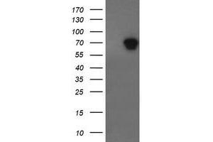 Western Blotting (WB) image for anti-ALX Homeobox 4 (ALX4) antibody (ABIN1496621) (ALX4 Antikörper)