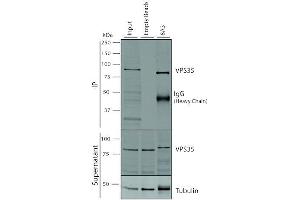Immunoprecipitation analysis using Mouse Anti-VPS35 Monoclonal Antibody, Clone 8A3 (ABIN6932968). (VPS35 Antikörper  (Biotin))