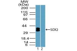 Image no. 1 for anti-SRY (Sex Determining Region Y)-Box 2 (SOX2) (AA 100-150) antibody (ABIN1490795) (SOX2 Antikörper  (AA 100-150))