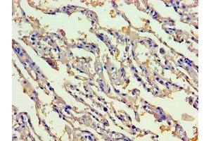 Immunohistochemistry of paraffin-embedded human lung tissue using ABIN7148026 at dilution of 1:100 (CBLIF (AA 19-417) Antikörper)