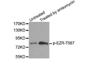 Western blot analysis of extracts from MDA cells, using Phospho-EZR-T567 antibody (ABIN2987611). (Ezrin Antikörper  (pThr567))