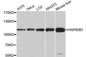 Western blot analysis of extracts of various cell lines, using HSP90B1 antibody (ABIN5970377) at 1/1000 dilution. (GRP94 Antikörper)