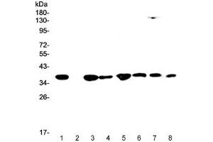 Western blot testing of human 1) HeLa, 2) placenta, 3) SW620, 4) PANC-1, 5) HepG2, 6) A549, 7) rat RH35 and 8) mouse HEPA1-6 lysate with SMN1/2 antibody at 0. (SMN1 / SMN2 Antikörper)