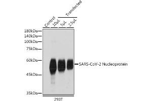 Western blot analysis of extracts of normal 293T cells and 293T transfected with Nucleoprotein,using SARS-CoV-2 Nucleoprotein antibody (ABIN7269053) at 1:1000 dilution. (Nucleoprotein Antikörper)