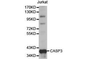 Western Blotting (WB) image for anti-Caspase 3 (CASP3) antibody (ABIN1871461) (Caspase 3 Antikörper)