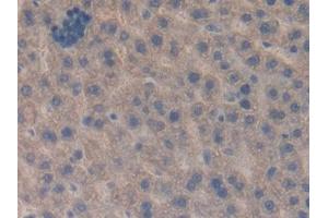 IHC-P analysis of Rat Liver Tissue, with DAB staining. (CTGF Antikörper)