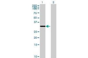 Lane 1: GLYATL1 transfected lysate ( 38. (GLYATL1 293T Cell Transient Overexpression Lysate(Denatured))