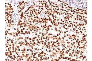 Image no. 1 for anti-Placenta Growth Factor (PGF) antibody (ABIN6189231) (PLGF Antikörper)