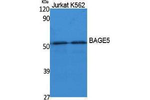 Western Blotting (WB) image for anti-B Melanoma Antigen Family, Member 5 (BAGE5) (N-Term) antibody (ABIN3178093) (BAGE5 Antikörper  (N-Term))