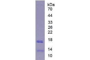 SDS-PAGE analysis of Human Lipase, Hepatic Protein. (LIPC Protein)