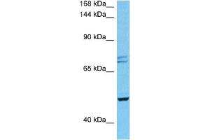 Host:  Mouse  Target Name:  PKD2  Sample Tissue:  Mouse Heart  Antibody Dilution:  1ug/ml (PKD2 Antikörper  (N-Term))