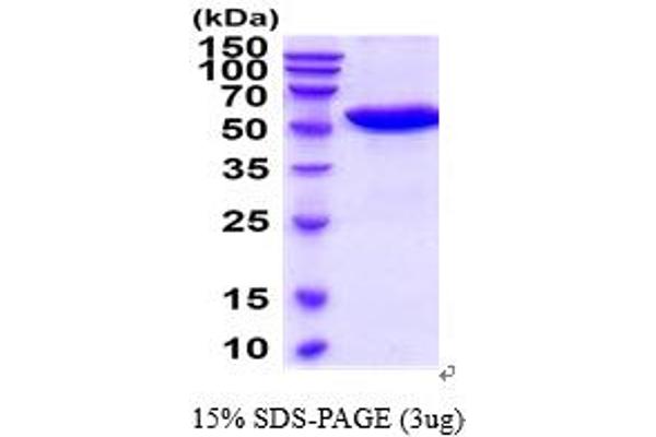 TIMP4 Protein (AA 30-224) (His tag)