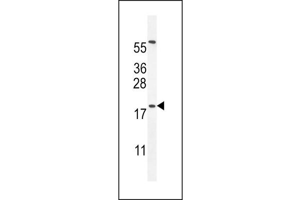 DPPA5 Antikörper  (N-Term)
